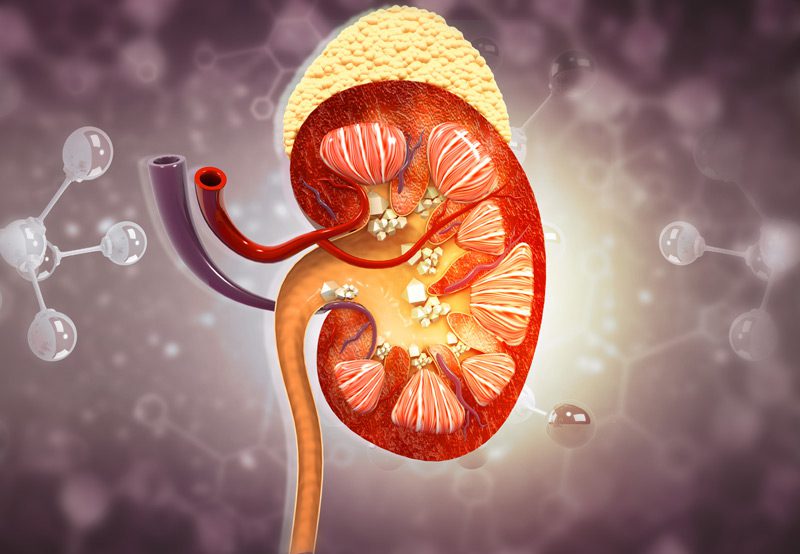 Illustration-of-kidney-stone-anatomy