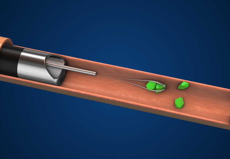 Medical-illustration-showing-human-kidneys-and-renal-anatomy